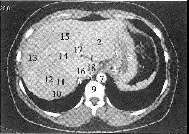 肝脏断层解剖分段图片